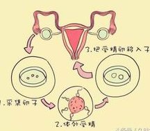 2026三代试管助孕生子要多少钱？国内外试管费用大不同