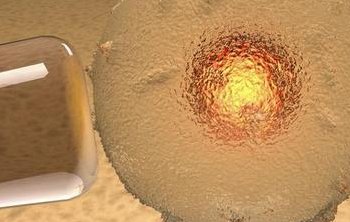 2026上海三代试管助孕费用明细，附价格一览