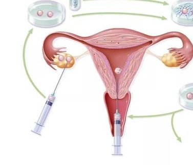 2026太原做三代试管助孕费用表公布，多少钱看完就知道了