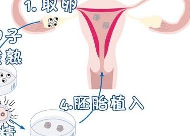 2026台州试管婴儿医院名单公布，附带试管费用